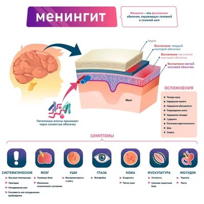 Менингит: кратко о заболевании и профилактике | Терапевт Варвара Веретюк |  Дзен