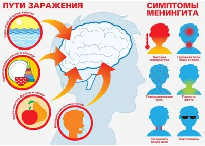 Исключительные симптомы менингита | Пикабу