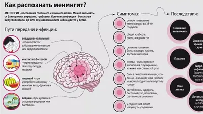 Менингит у взрослых и детей - симптомы, признаки и причины. Диагностика  заболевания