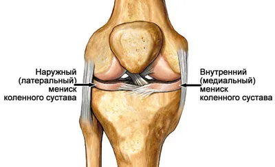 Повреждение мениска | Пикабу