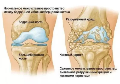 Травмы коленного сустава — лечение в Ростове-на-Дону | Цены и отзывы