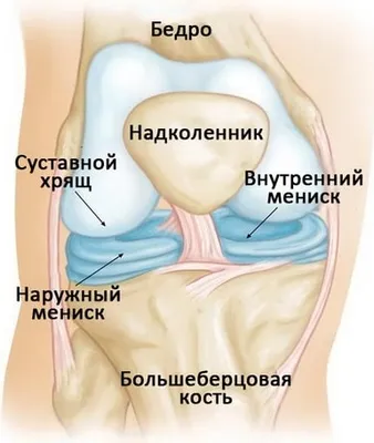 Лечение разрыва мениска бесплатно по ОМС