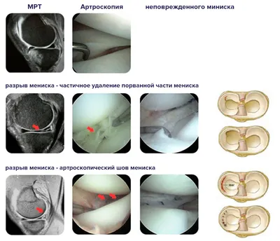Мениск и Co. Травмы колена. - Форум onliner.by