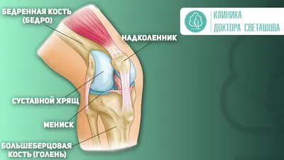 Артроскопия мениска коленного сустава — цена опрерации в Москве | «Центр  Спортивной Травмы»