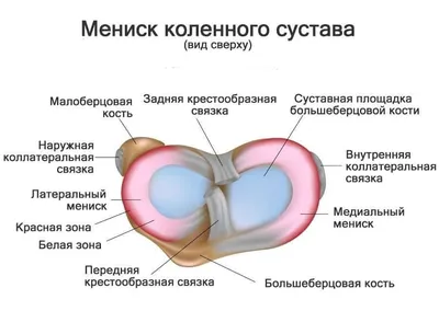 Разрыв менисков коленного сустава