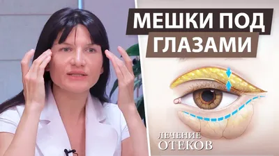 Почечные отеки у пожилых: о чем говорит отечное лицо | Пансионаты «Забота о  близких» | Дзен