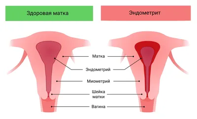 Таблетки Bayer Визанна - «М-даа! И вам не помогло - сказал мне узист. Зачем  всем выписывают Визанну при эндометриозе, если есть более дешевые и такие  же бесполезные аналоги?» | отзывы