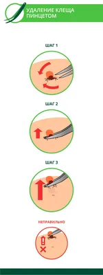 Укус клеща: симптомы, действия и последствия для человека - 7Дней.ру