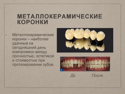 Фото зубов до и после