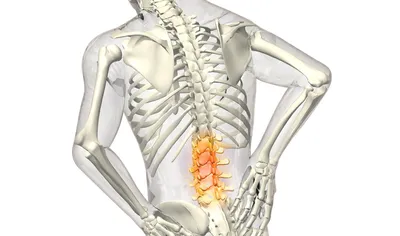 Грыжа позвоночника — симптомы и лечение межпозвоночной грыжи