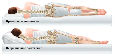 Грыжа диска C5-C6 шейного отдела позвоночника: лечение и симптомы | Клиника  Temed