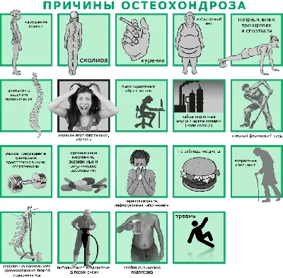 Упражнения при протрузии позвоночника | Блог о здоровье