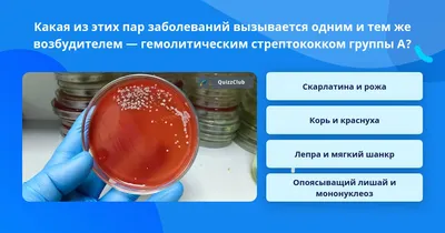 АНО ДПО АМО - ⭕ Шанкроид - инфекционное заболевание, относящееся к  венерическим патологиям. Передаётся половым путём, с образованием гнойных  язв в области половых органов. При мягком шанкре наблюдают воспалительные  процессы в региональных