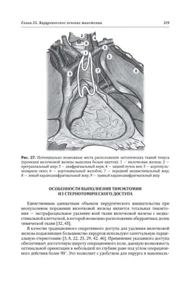 миастения Гревиса стоковое фото. изображение насчитывающей веко - 284670750