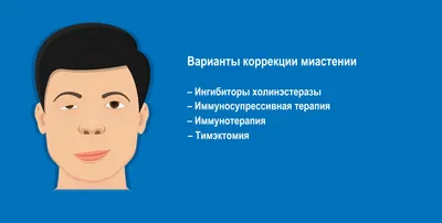 Миастения Гравис - что это такое, симптомы, причины, лечение, клинические  рекомендации