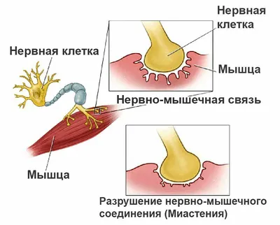 Отзыв. Диагноз миастения, парез гортани и исчезающая форма щитовидной  железы. — Ирина Ханамирян на TenChat.ru