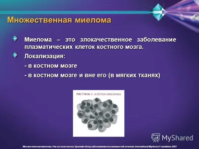 PDF) ОПИСАНИЕ СЛУЧАЕВ МНОЖЕСТВЕННОЙ МИЕЛОМЫ У БОЛЬНЫХ МНОГОПРОФИЛЬНОГО  СТАЦИОНАРА