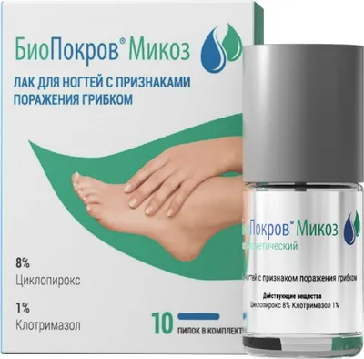 Лечение грибка стопы (микоз) в Киеве — Derma.ua