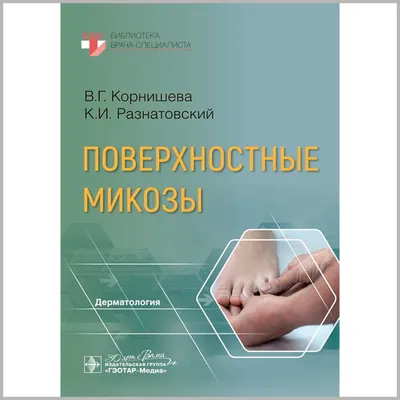 Микоз гладкой кожи - что это такое, лечение грибкового заболевания,  симптомы, сколько лечится грибок на теле, виды и как передается  микотическое поражение