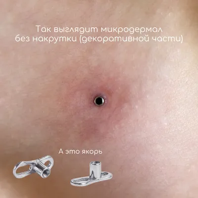 Микродермал на шее - цена пирсинга в Москве | «Piercing.Wiki»