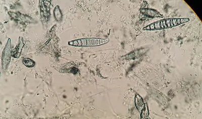 Микроспория. Профилактика и описание. » Гродненская Областная Клиническая  больница Медицинской Реабилитации