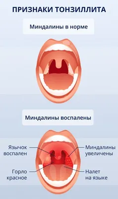 Анатомия мозговой миндалины Векторное изображение ©Pikovit 517046034