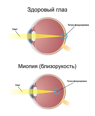 Methodology OrphanAnaesthesia