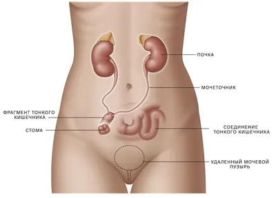 Связи в нашем теле, о которых вы не знали. Мочевой пузырь. | Студия красоты  и здоровья | Дзен