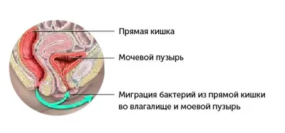 Лопнет ли мочевой пузырь? - Ортодонтическая клиника \"Альтер Эго\". Спб.