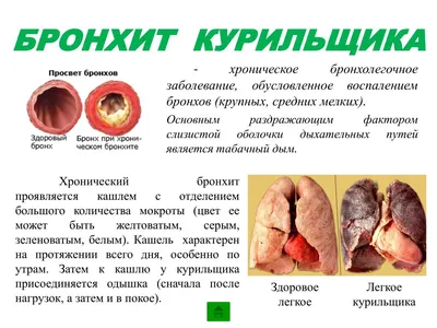 31 мая – Всемирный День против курения | Городская поликлиника №72