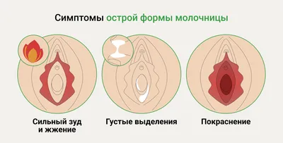 Лучшие средства от молочницы у женщин 2023: рейтинг