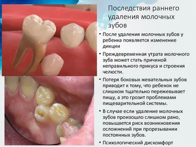 Выпадение молочных зубов у детей - возраст, сроки, схема, порядок