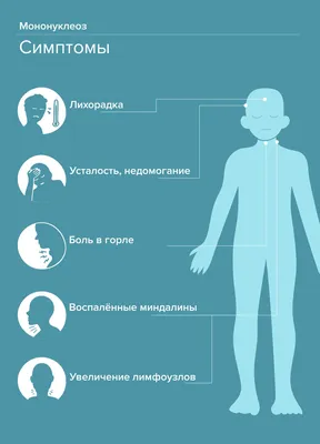 Мононуклеоз у детей: причины, симптомы, диагностика и лечение