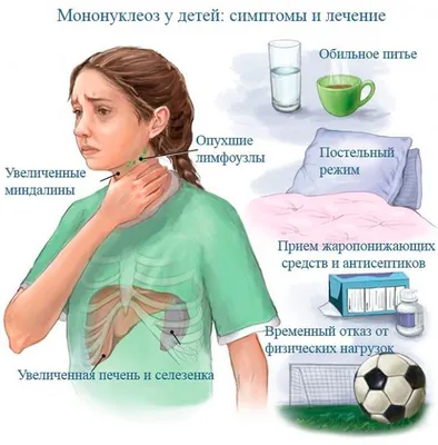 Инфекционный мононуклеоз. Симптомы. Диагностика. | «Наш лецитин»