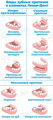 Протезирование зубов - цены на зубные протезы в Нижнем Новгороде от 6000  руб | Сколько стоит протез на 1 зуб | Стоматология «Имплант 52»