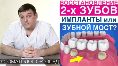 Протезирование зубов на имплантах в Краснодаре. Установка импланта зуба.  Цены в «Smile Clinic»