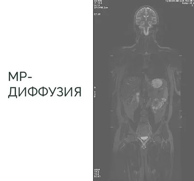 DICOM Viewer изнутри. Функциональные возможности / Хабр