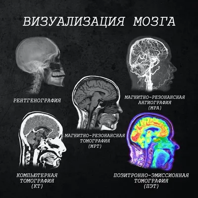 МРТ платно в медицинском центре ИМРЕД (IMRED)