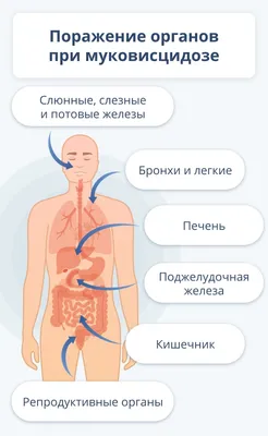 Руководства о муковисцидозе