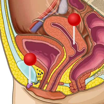 Строение женской репродуктивной системы и таза: иллюстрации с надписями |  e-Anatomy