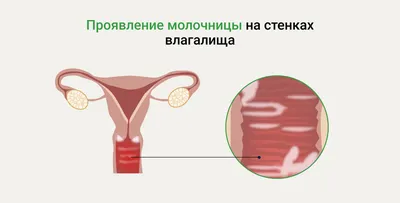 Женский таз : нормальная анатомия | e-Anatomy