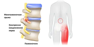 Копчик: истории из жизни, советы, новости, юмор и картинки — Горячее,  страница 3 | Пикабу