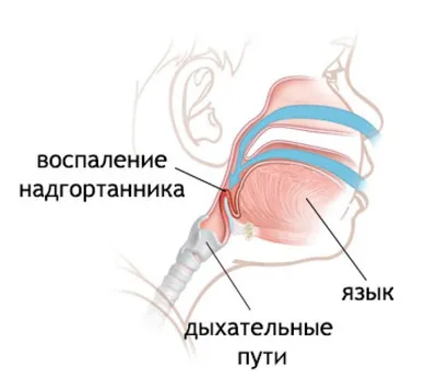 Почему, когда мы глотаем, еда не оказывается в лёгких? Надгортанник —  эластичный хрящ гортани. Имеет вид тонкого листа-пластинки.… | Instagram