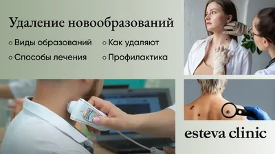 Цыпки: что это, причины появления на руках, чем лечить | РБК Life