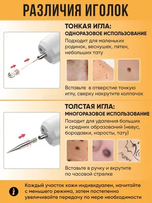 Средство для удаления кролей, удалите бирки и средство для удаления кролей,  натуральные не раздражающие жидкие кроты, легкое удаление бирок и кролей  кожи | AliExpress