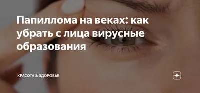 Желтые пятна на белке глаза: причины, диагностика и лечение в ГКДБ