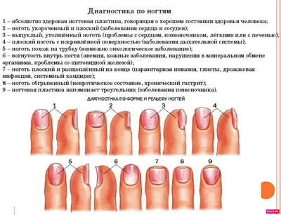 Негрибковые заболевания ногтей на ногах фото