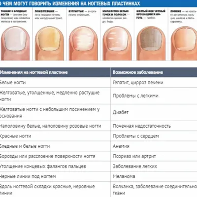 Курс \"Медицинский аппаратный педикюр\" в Херсоне - Академия Клеопатра