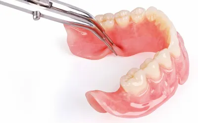 Нейлоновые протезы — цена на съемные гибкие зубные протезы в Минске