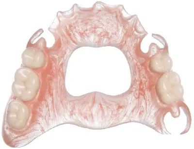 Новое поколение зубных протезов без неба: виды, фото и отзывы -  Стоматология Эспадент